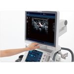 TOSHIBA Aplio 500 Ультразвуковой сканер Premium класса